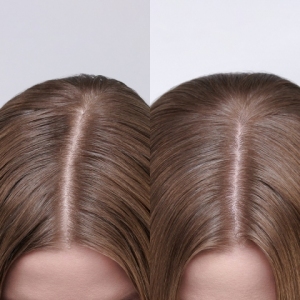 Moroccanoil Scalp Treatment Dry za suvo teme Moroccanoil Scalp Treatment Dry za suvo teme