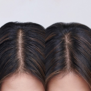 Moroccanoil Oily Scalp Tretman za masno teme